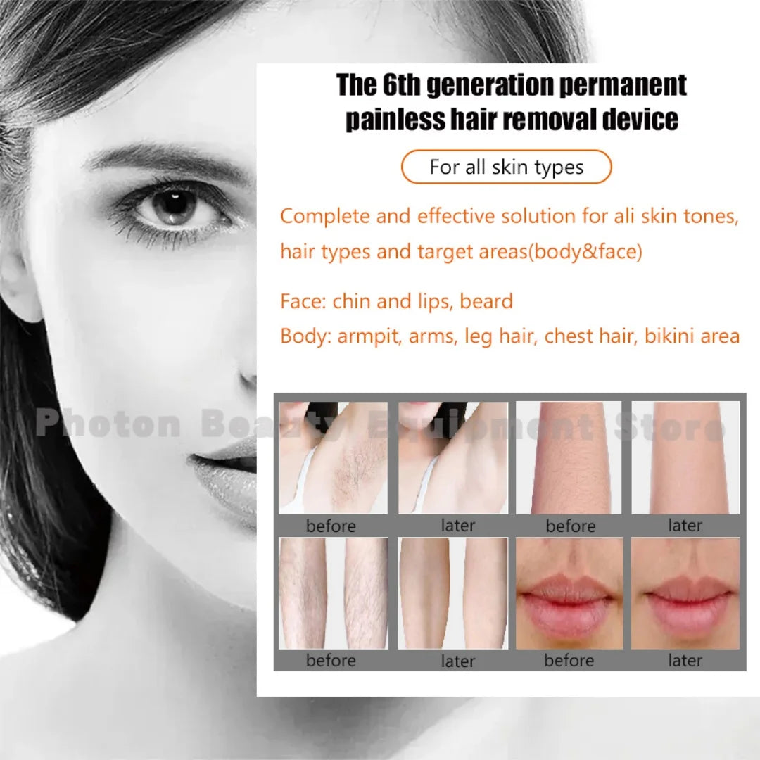 4000w Mini Ice Platinum Epilator 808nm Diode  Hair Removal  Machine Skin Rejuvenation Affordable Options for Beauty Studios