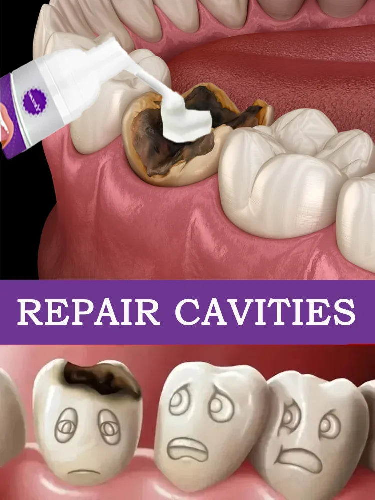 Anti Caries Tooth Decay Healing Cavities