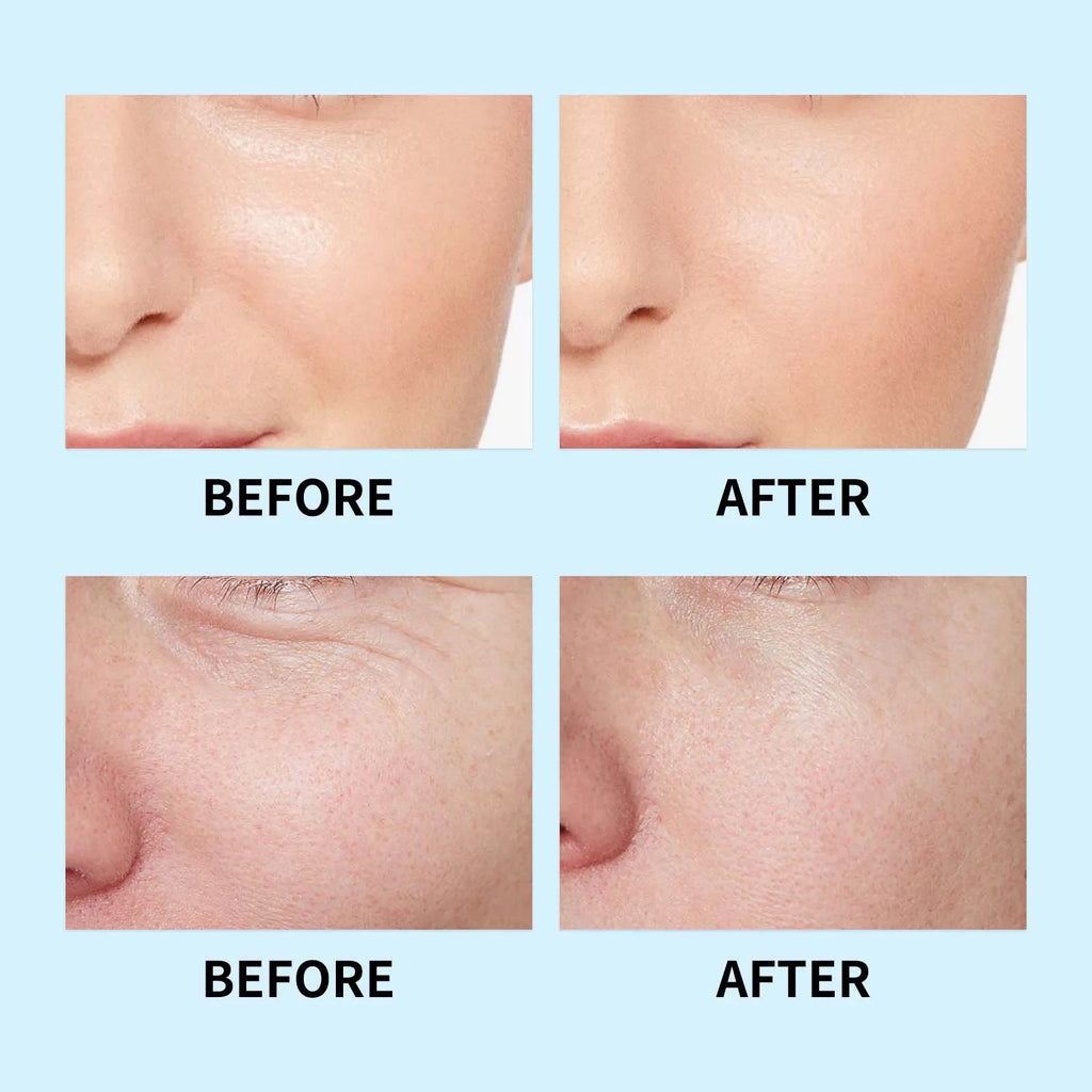Hyaluronic Acid Liquid Serum Facial Moisturizing Lifting Glow Up Facial Essence Quick Absorption Dermapen Serum Skin Care
