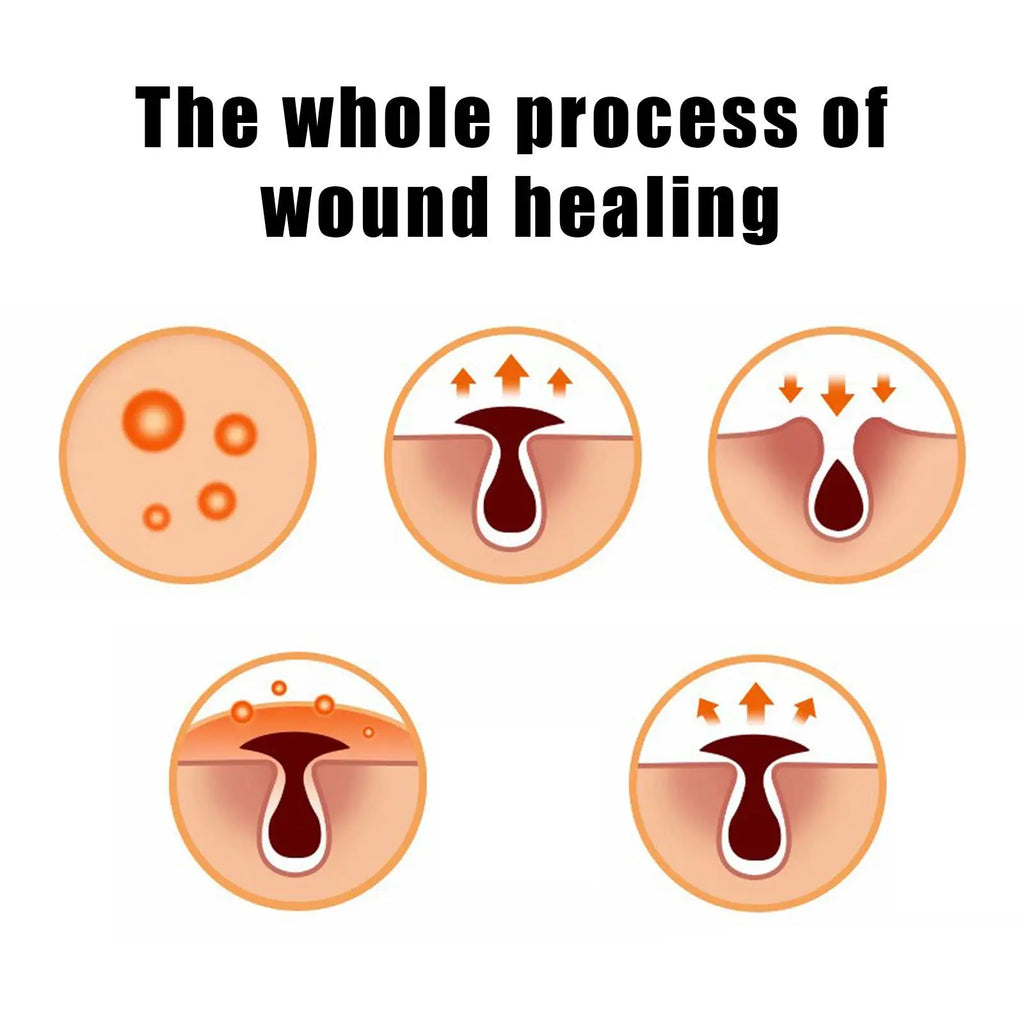 Scar Repair Cream Skin Wound Cream Burning Fading Cream Surgery Repair Scar