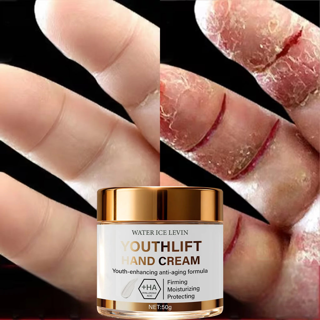 YouthLift Anti-Aging Hand Cream with HA & Retinol for Firming, Moisturizing & Protecting Mature Skin.