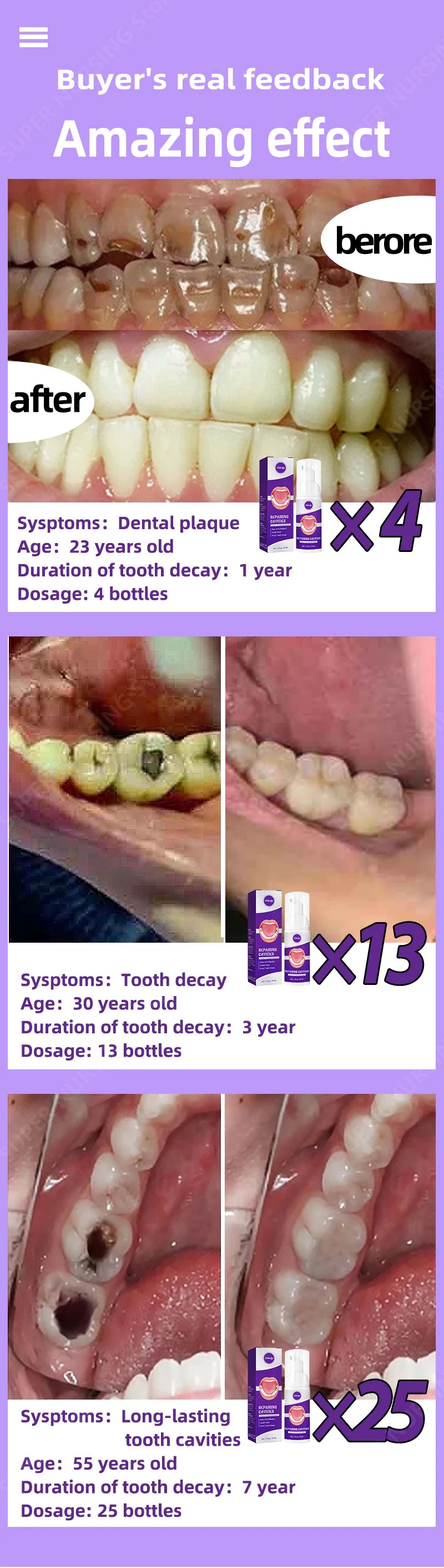 Anti Caries Tooth Decay Healing Cavities