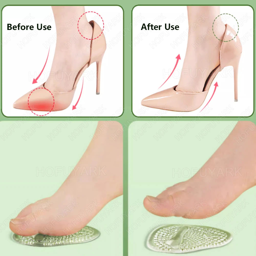 2Pairs Silicone Insoles for Shoes Insert High Heels Non-Slip Self-Adhesive Gel Metatarsal Foot Pads for Pain Relief Shoe Pads