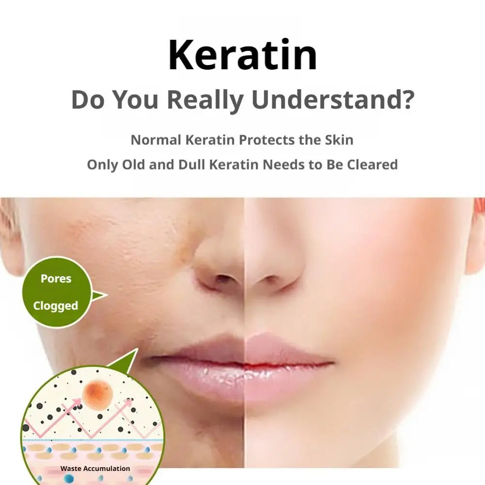 Fruit Acid Peeling Gel Facial Cleansing Exfoliating Peeling Scrub Cream Deep Clean Moisturizing Blackhead Removal Face Cleanser