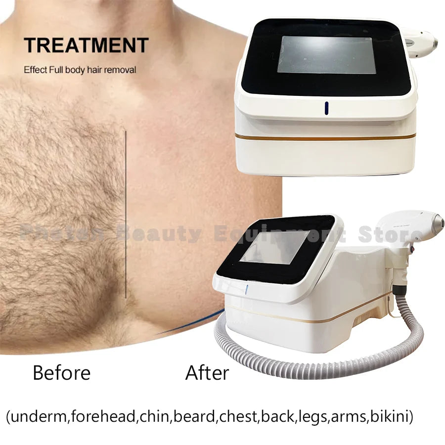 4000w Mini Ice Platinum Epilator 808nm Diode  Hair Removal  Machine Skin Rejuvenation Affordable Options for Beauty Studios