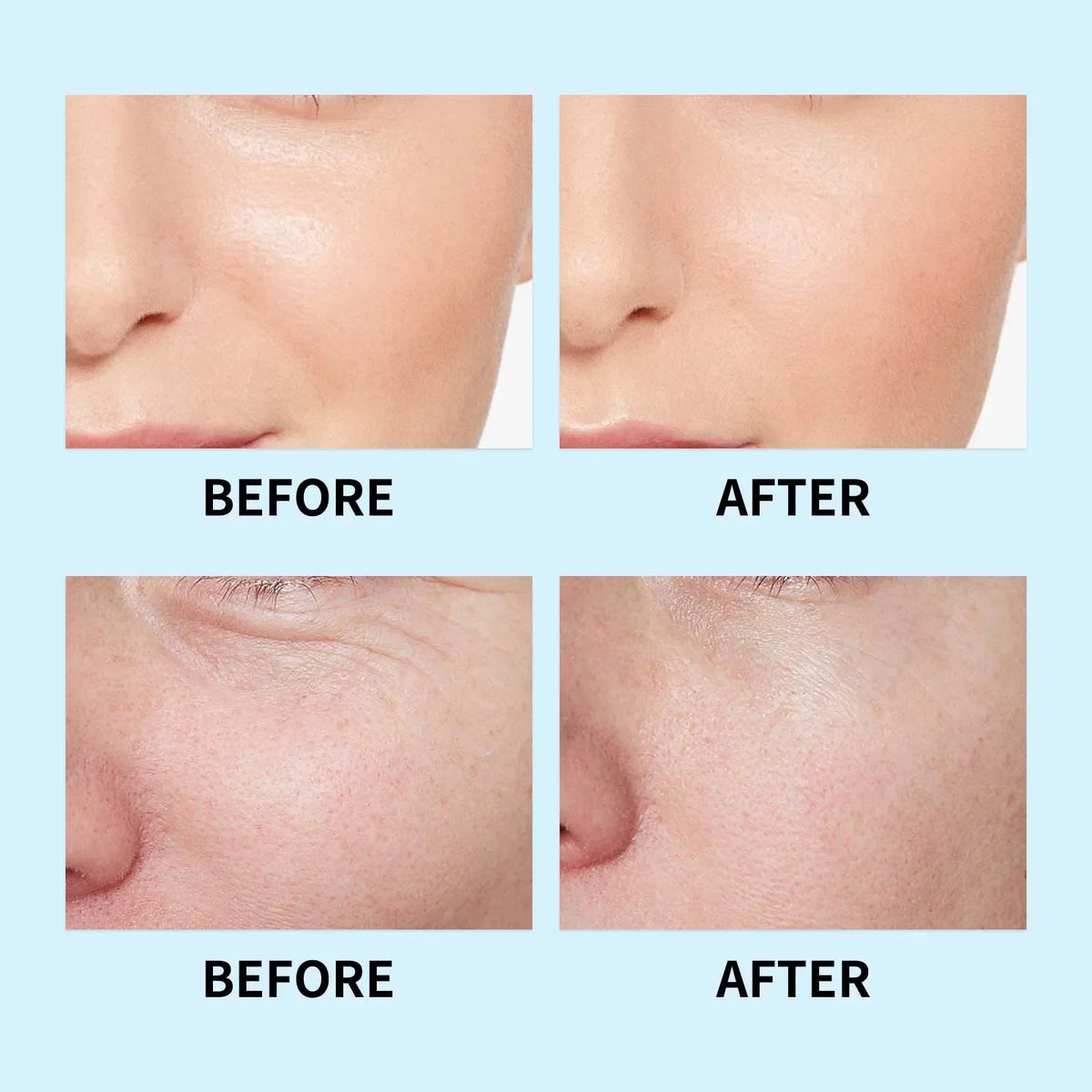 Hyaluronic Acid Liquid Serum Facial Moisturizing Lifting Glow Up Facial Essence Quick Absorption Dermapen Serum Skin Care