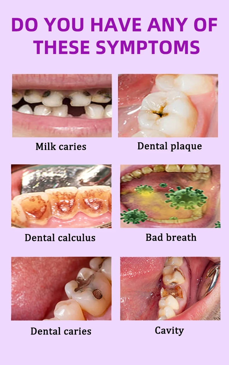 Anti Caries Tooth Decay Healing Cavities