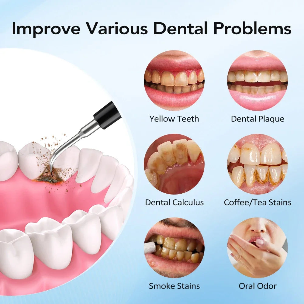 Electric Toothbrush 5 Modes IPX6 Waterproof 31000 VPM ABS Teeth Cleaner with 500mAh Battery Type-C Charge Oral Care Cleaner