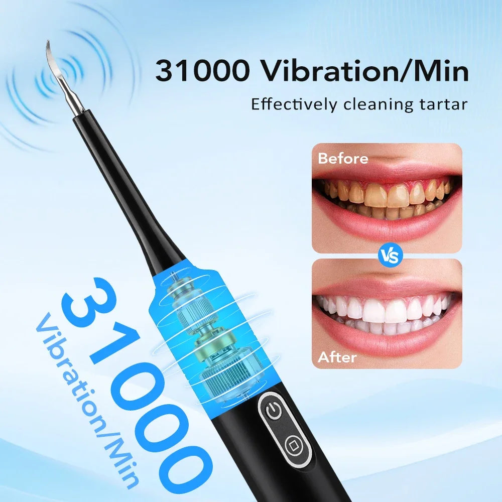 Electric Toothbrush 5 Modes IPX6 Waterproof 31000 VPM ABS Teeth Cleaner with 500mAh Battery Type-C Charge Oral Care Cleaner
