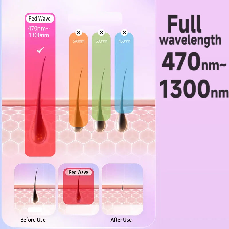 999999 Flashes IPL Laser Epilator for Women  Home Use Devices Hair Removal Painless Electric Epilator Bikini Dropshipping